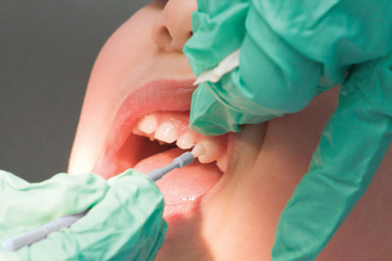 Topical Fluoride Training